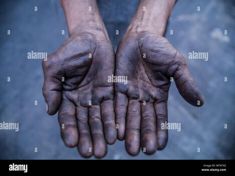 GreasyHands